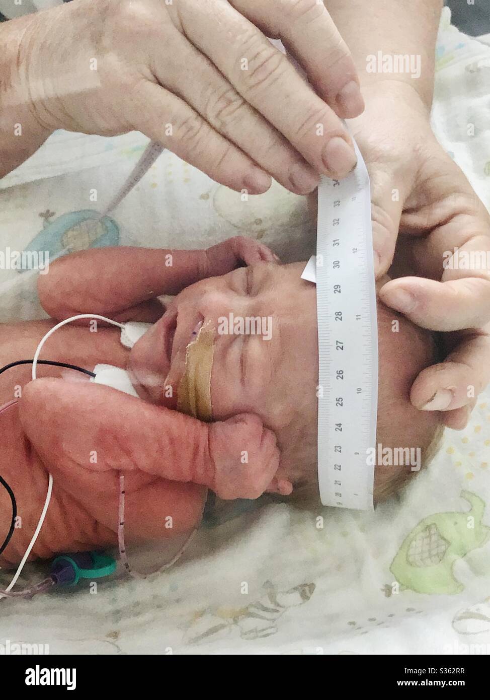 Une Infirmiere Mesure Le Perimetre Cranien D Un Bebe Premature De 12 Jours Ne A 30 Semaines Photo Stock Alamy Une Infirmiere Mesure Le Perimetre Cranien D Un Bebe Premature De 12 Jours Ne A 30 Semaines Photo Stock Alamy