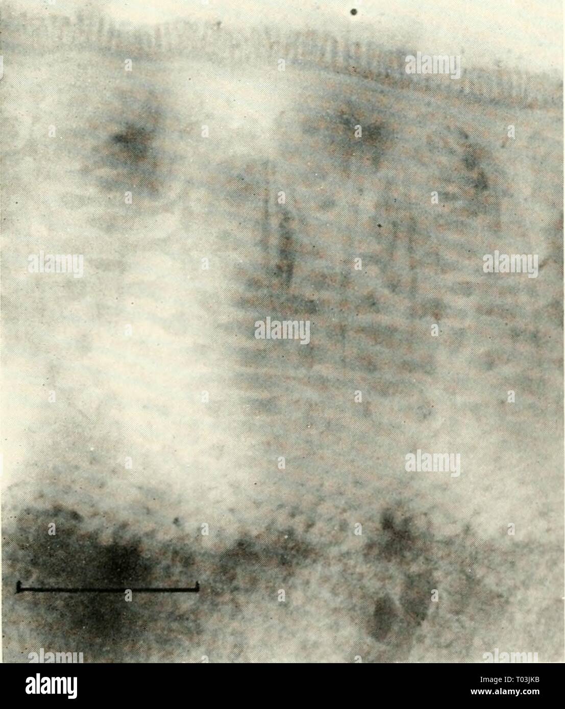 La microscopie électronique ; actes de la Conférence de Stockholm, septembre 1956 . electronmicrosco00euro Année : 1957 Études sur la Fibrogénèse du collagène Sylvia Fitton Jackson Conseil de recherches médicales en biophysique à l'unité de recherche, Laboratoire d'Wheatsioiie, King's College, Londres, W.C.2 protéine de collagène est largement distribué dans les différents embranchements du règne animal (3 ; Rudall, 1955). La reconnaissance de sa présence peut être fondée dans le caractéristique des diagrammes de fibres obtenues à partir de va- rious matériaux par le biais d'high angle x-ray ditlYac- tion. Bien que différentes sources de fibres de collagène diagrammes donner indi Banque D'Images