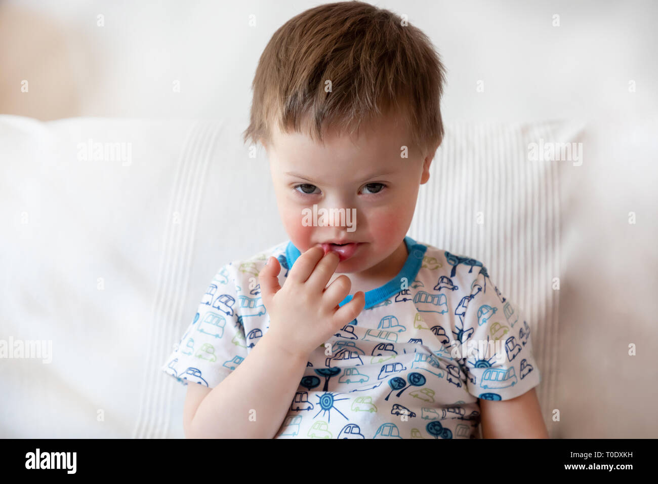 Down syndrome baby Banque de photographies et d'images à haute résolution -  Alamy