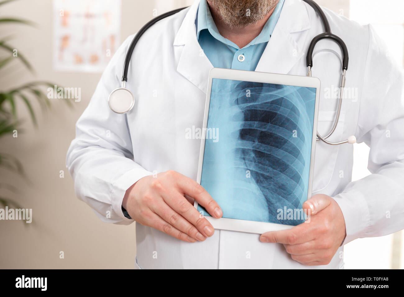 Médecin homme montrant une image de radiographie numérique sur une tablette Banque D'Images
