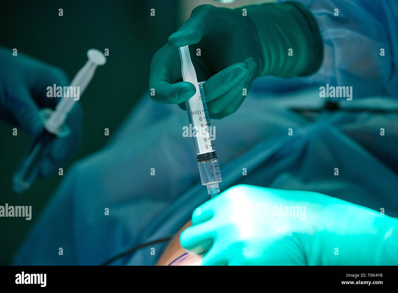 Close up photo de la main du médecin tandis qu'injecter l'anesthésique sous la peau du patient. L'anesthésie locale était utiliser avant d'exécuter la chirurgie Banque D'Images