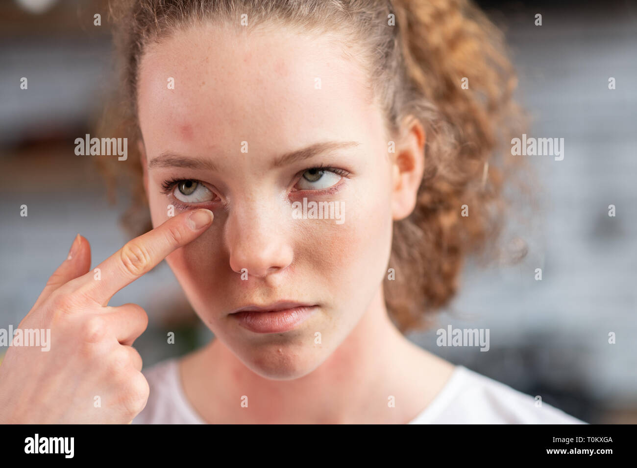 Malheureux jeune femme ayant les yeux sensibles durant allergy Banque D'Images