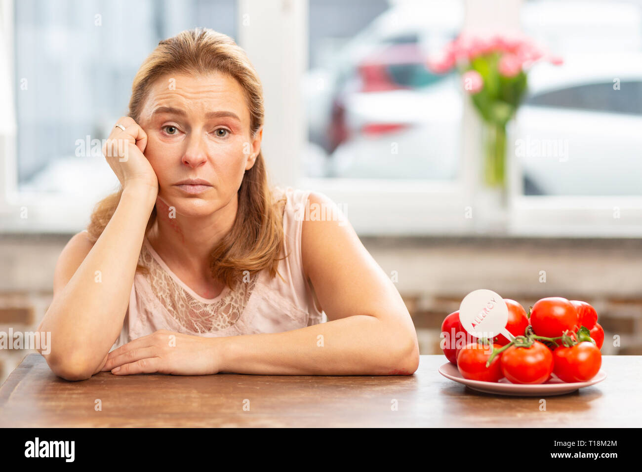 Blonde mature femme brune assise à la table après avoir allergie alimentaire Banque D'Images