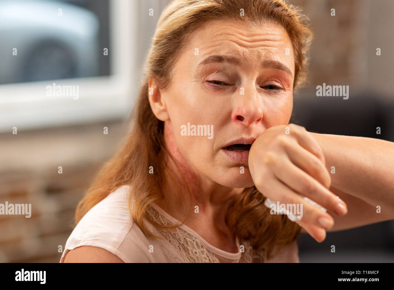 Femme d'écoulement nasal et la toux qui souffrent d'allergie Banque D'Images