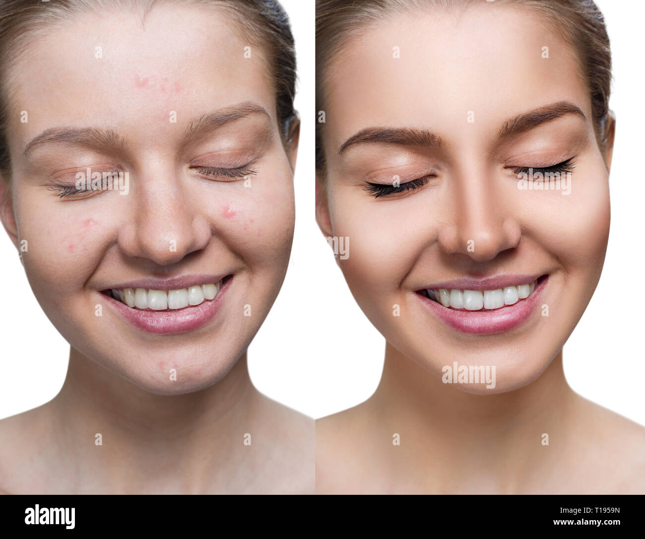 Jeune femme avant et après traitement de la peau et maquillage. Banque D'Images