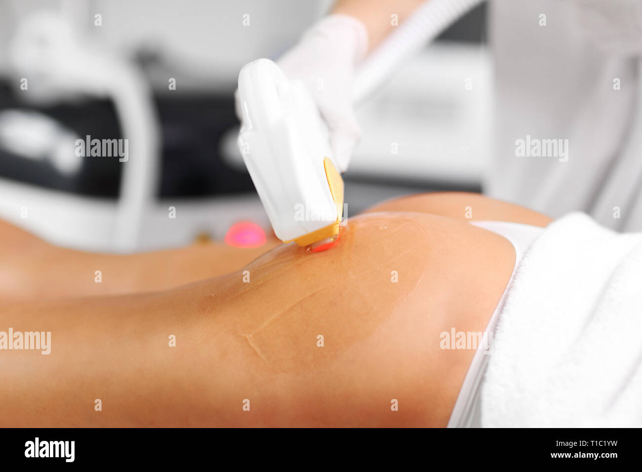 Photo de traitement au laser épilation Beauté donnant à la femme sur les  fesses Photo Stock - Alamy