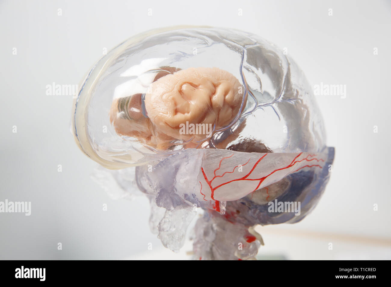 Modèle 3D du cerveau humain avec la moelle épinière. La démence, d — free download