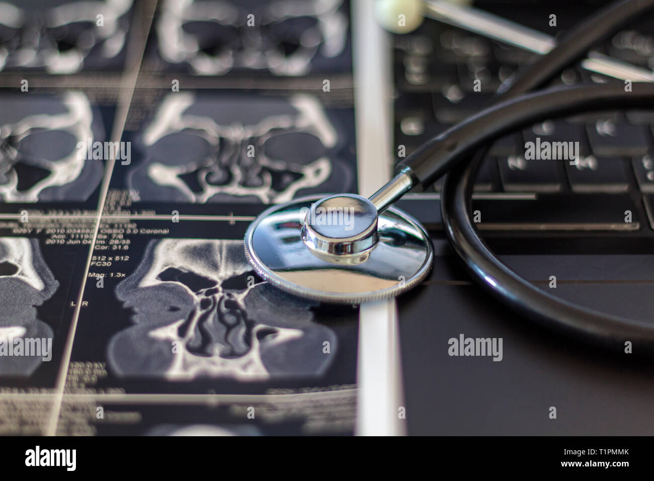 Stéthoscope médical et CT scan. on laptop computer concept médical Banque D'Images