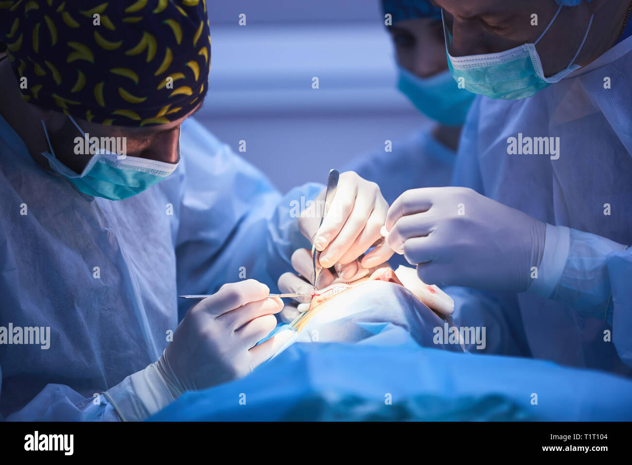 L'exécution de l'équipe chirurgicale en chirurgie opération moderne theatre,équipe de médecins se concentrant sur un patient durant une opération chirurgicale,équipe de médecins travaillant Banque D'Images