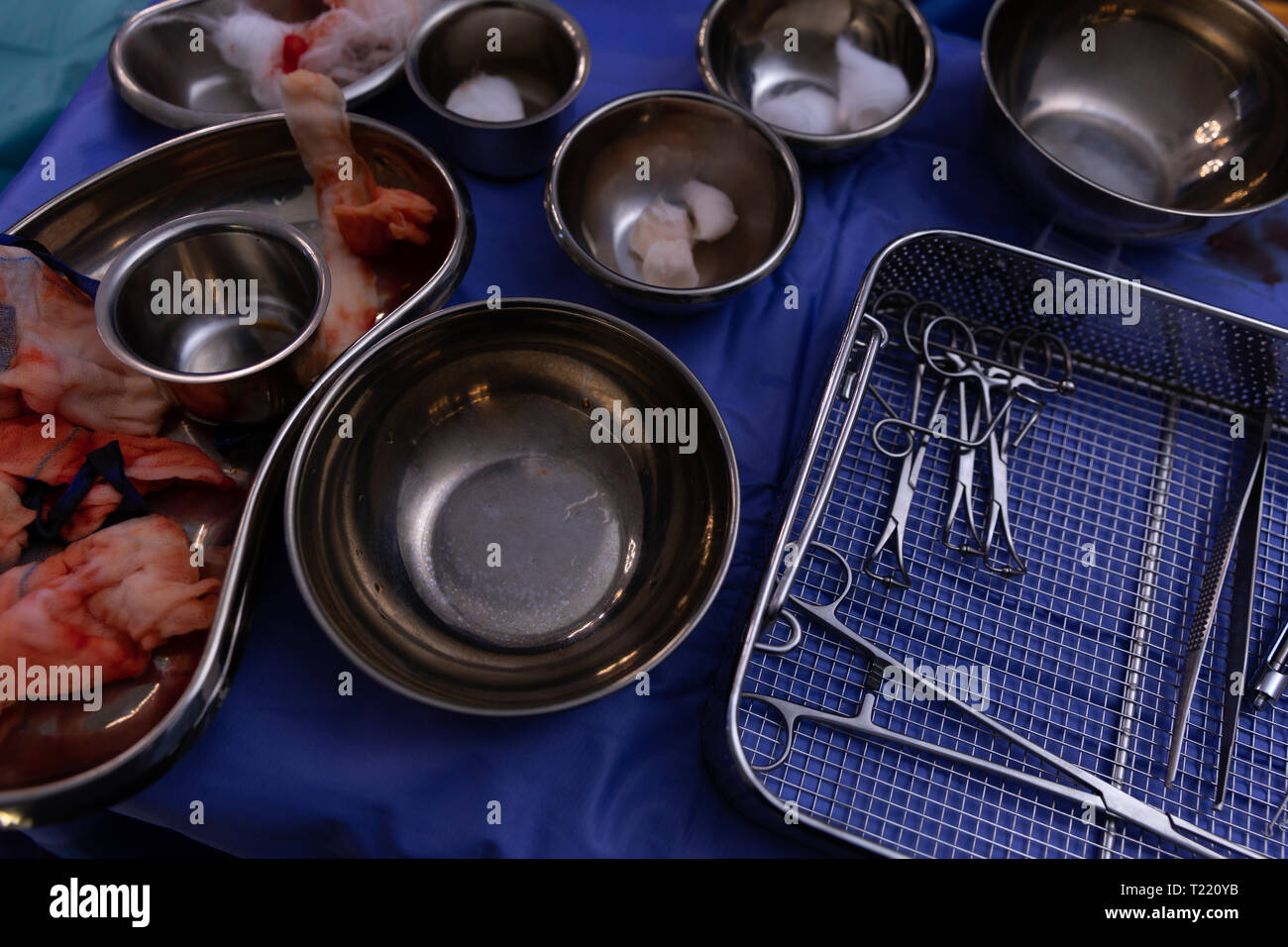 Le matériel chirurgical sur une table en salle d'opération pendant la chirurgie Banque D'Images