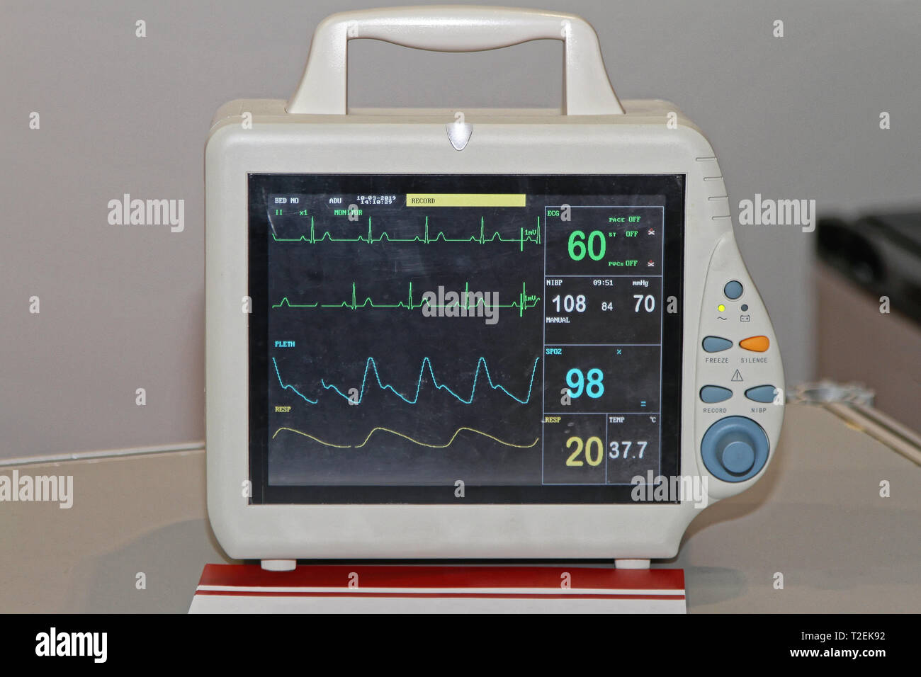 La fréquence cardiaque à l'hôpital Unité moniteur patient Photo Stock -  Alamy