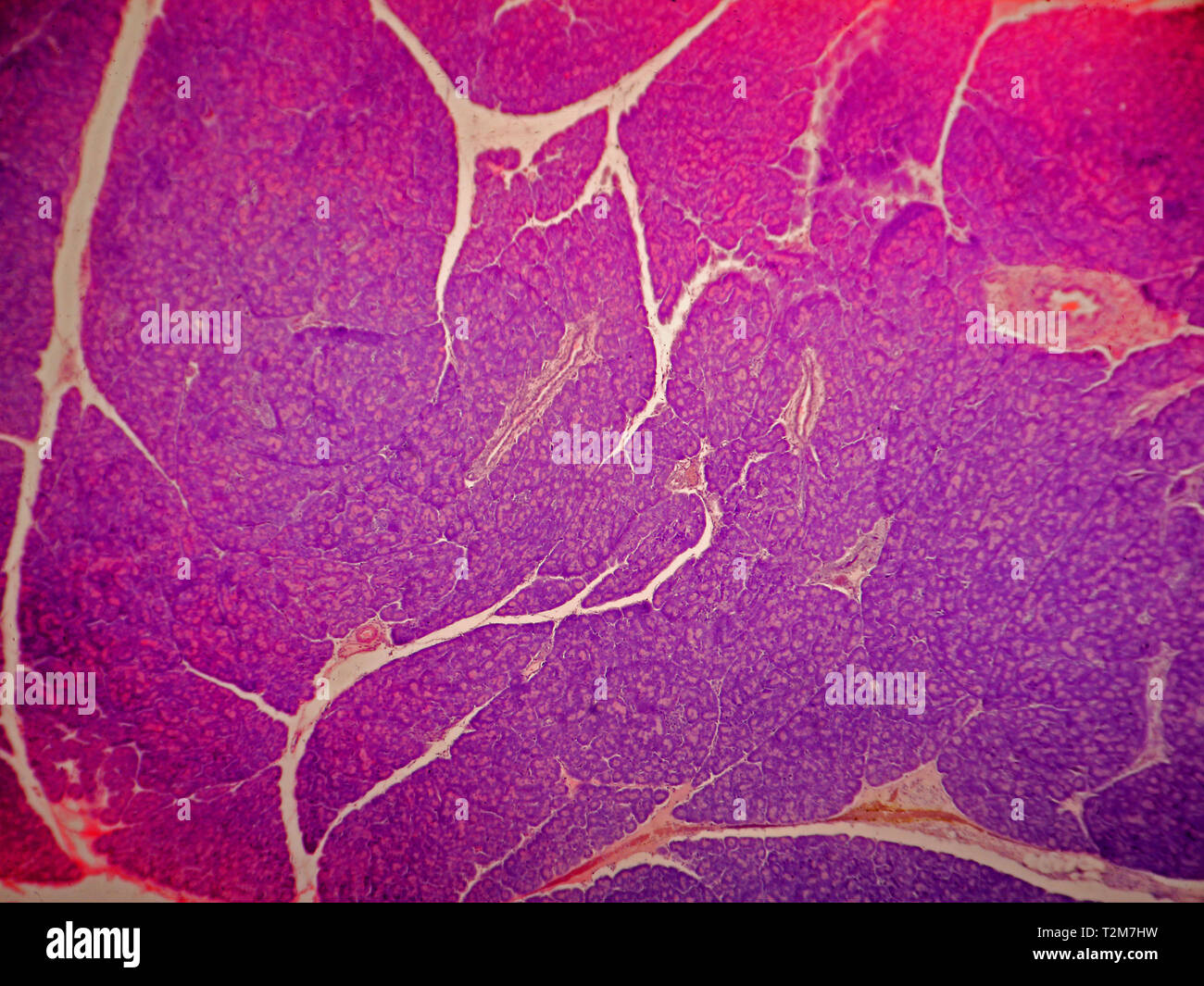 Pancreas cell Banque de photographies et d’images à haute résolution ...