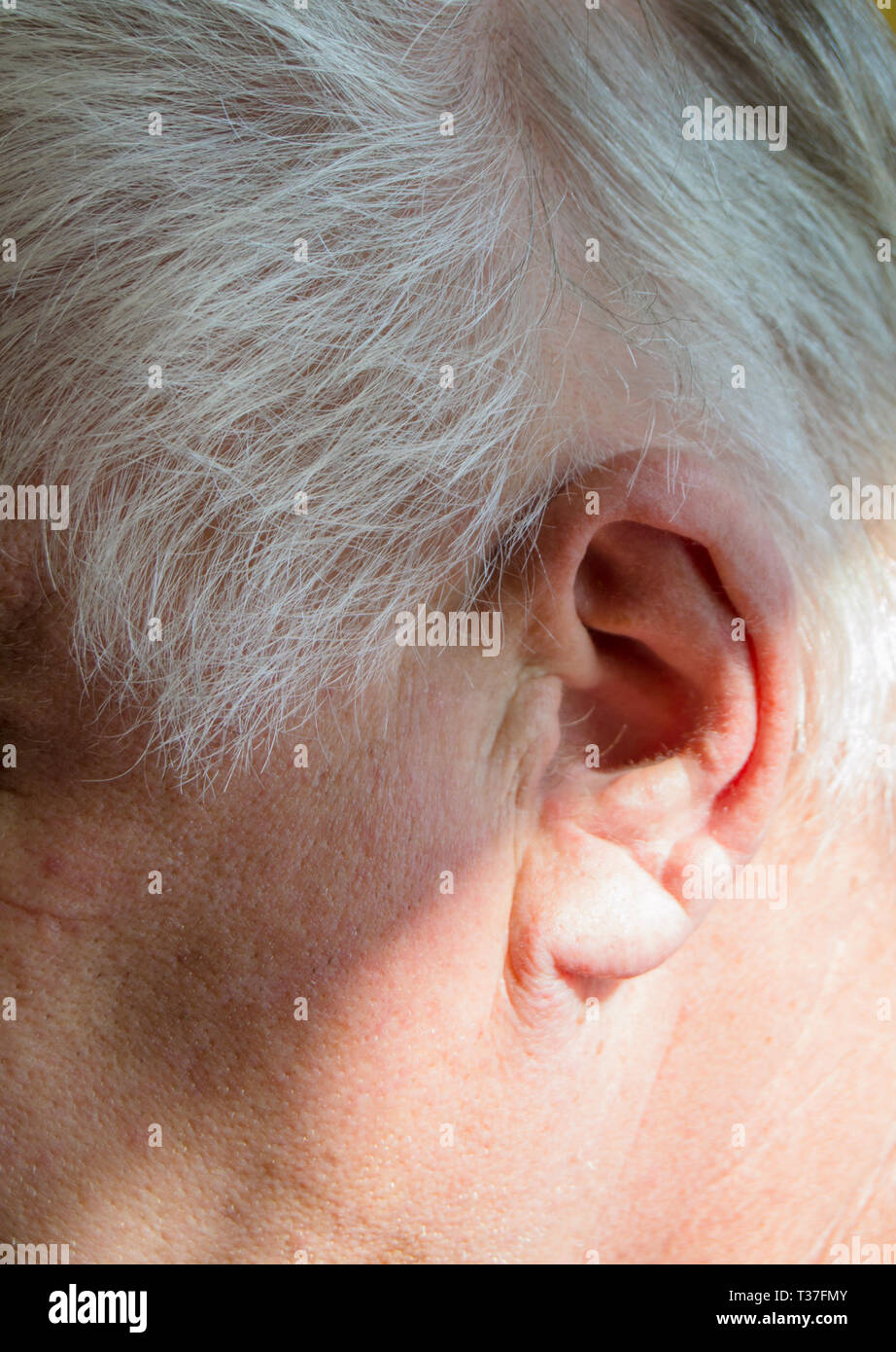 L'oreille gauche d'un vieil homme aux cheveux gris avec une perte de l' audition, des problèmes d'audition, le concept de réhabilitation de vieux  personnes sourdes Photo Stock - Alamy
