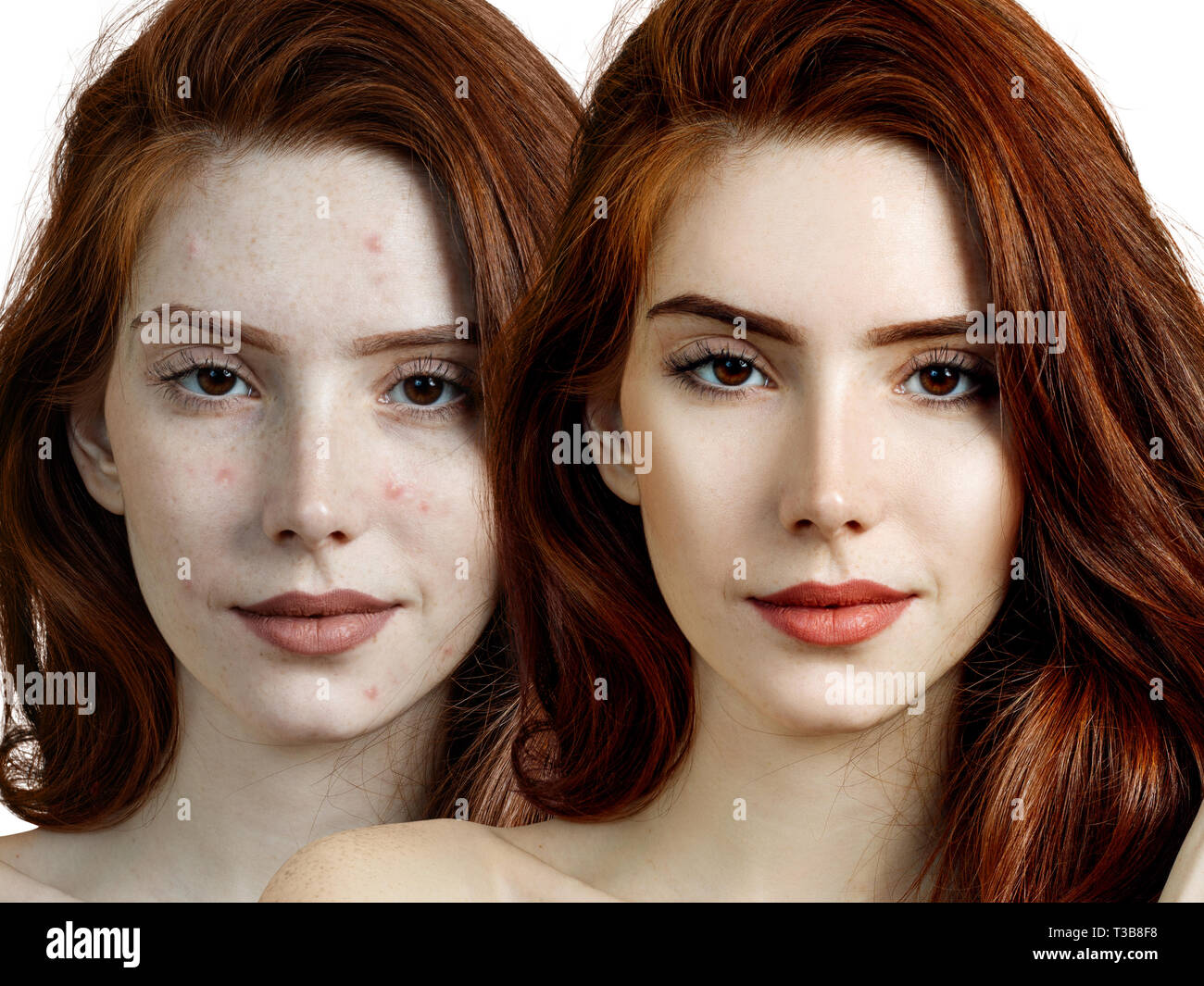 Jeune femme avant et après traitement de la peau et maquillage. Banque D'Images