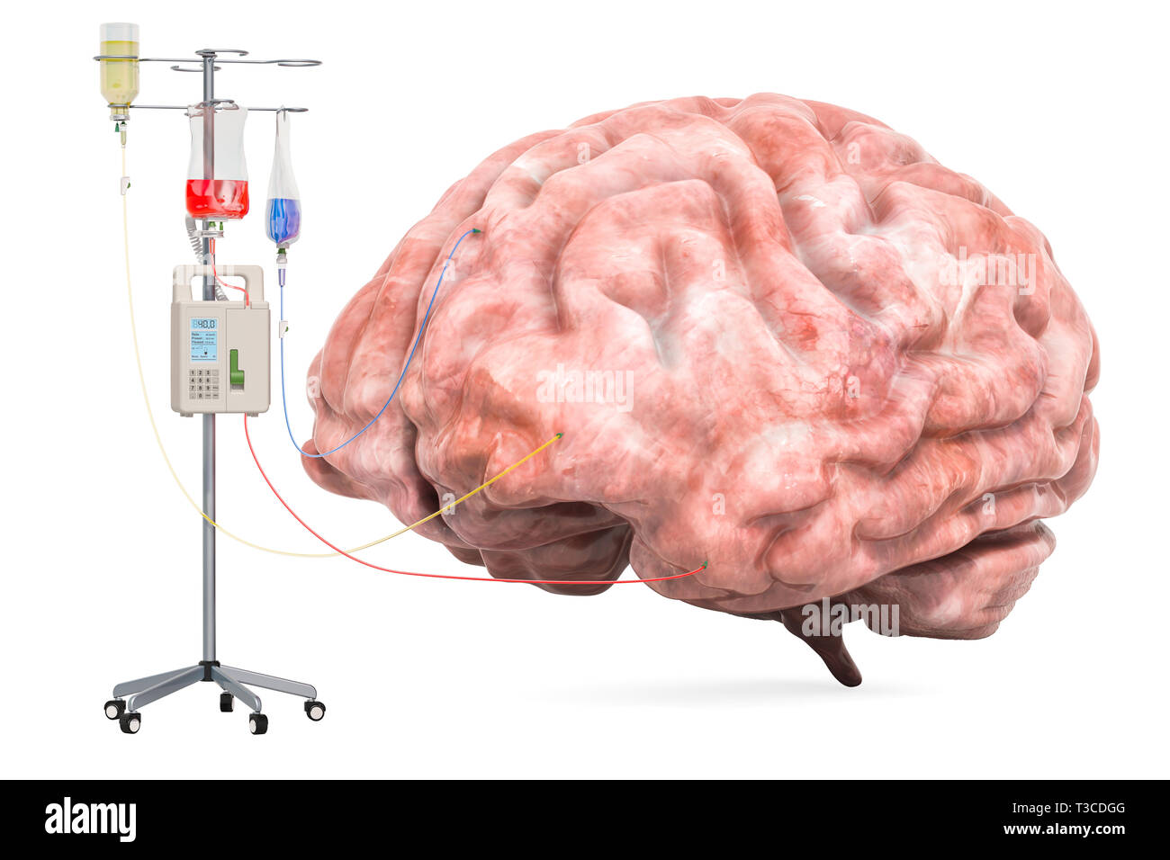 Système de thérapie intraveineuse avec cerveau humain. Traitement des maladies du cerveau concept. Le rendu 3D isolé sur fond blanc Banque D'Images