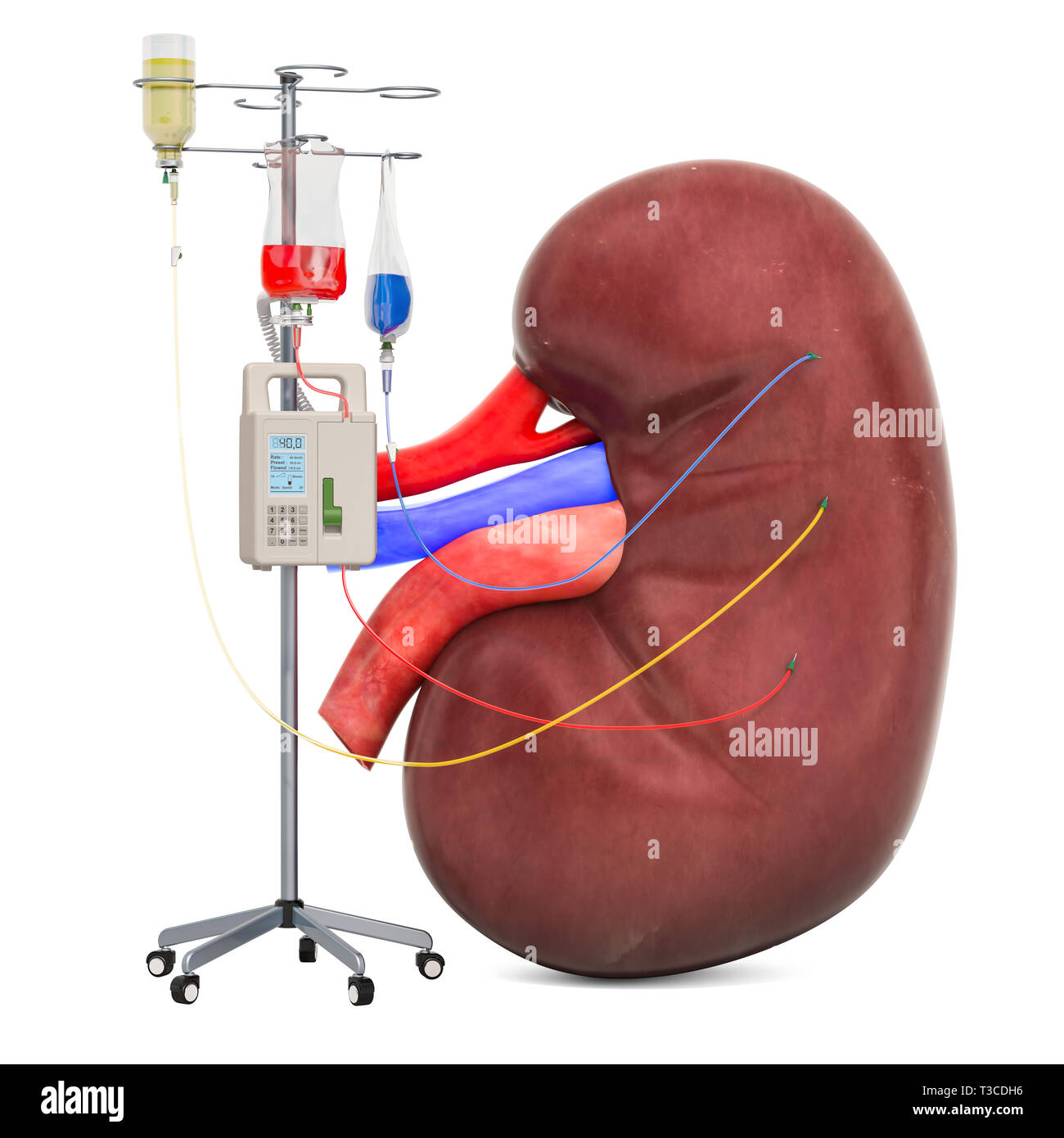 Système de thérapie intraveineuse avec rein humain. Traitement des maladies du rein, rendu 3D concept isolé sur fond blanc Banque D'Images