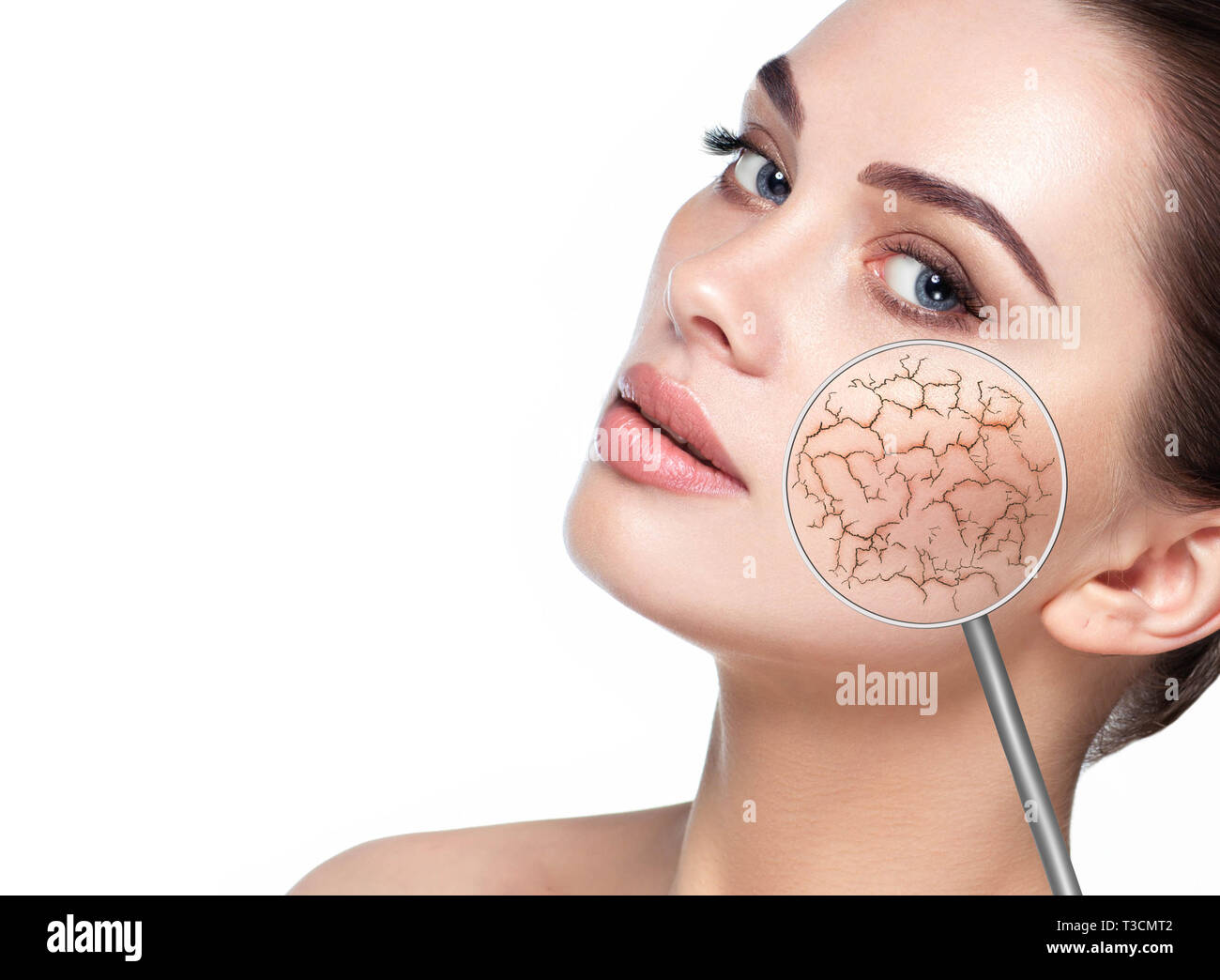Visage de femme montrant à l'aide de la peau du visage sec agrandir verre. Peau sèche, sans humidification fissuré Banque D'Images