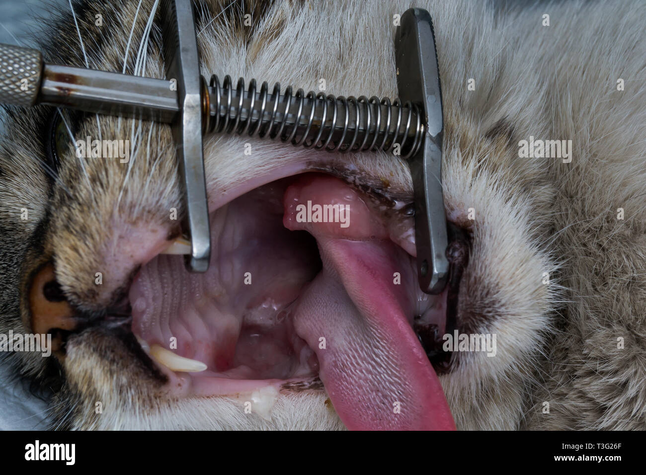 Epulis Banque D Image Et Photos Alamy Epulis Banque D Image Et Photos Alamy