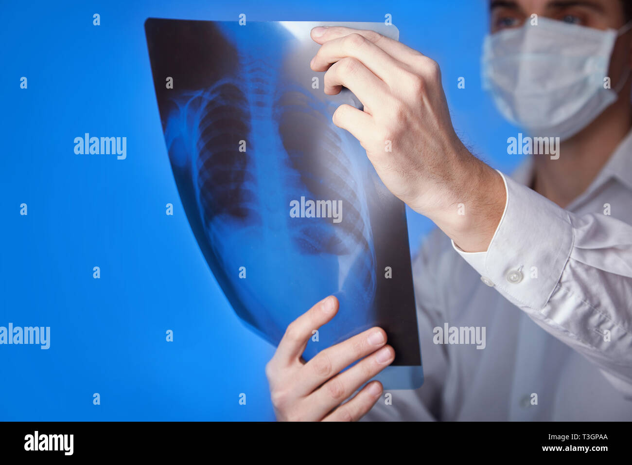 Médecin homme en blouse blanche et masque holding x-ray ou de roentgen, poumons, graphie image sur fond bleu Banque D'Images