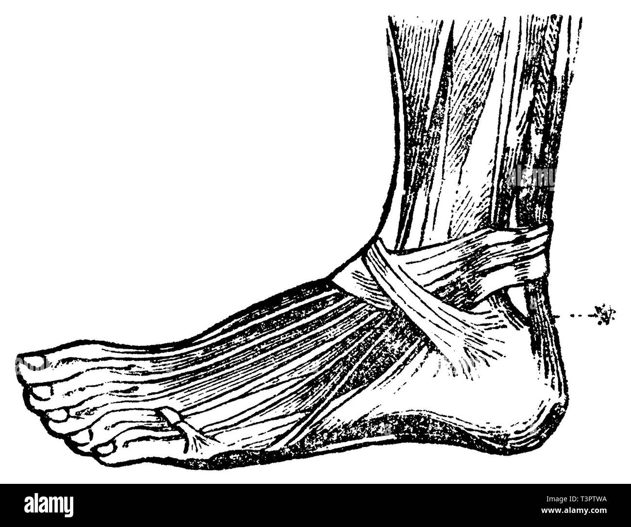 Homme : Pied : tendon d'Achille, anonym 1887 Banque D'Images