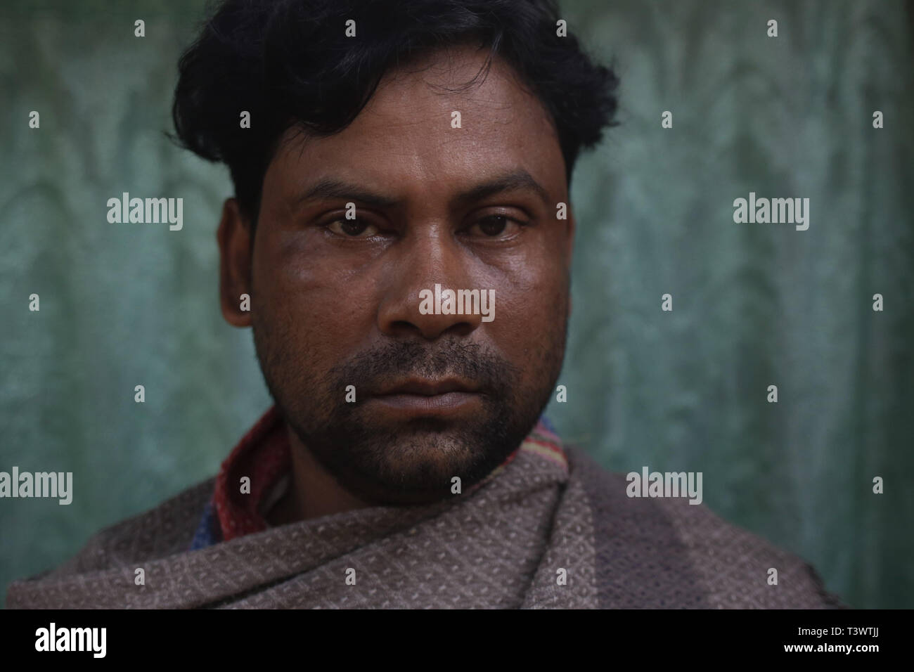 Joypurhat, au Bangladesh. 12 avr, 2019. Une victime pose pour une photo comme il avait un rein illégal retiré dans un village voisin de Joypurhat District nord du pays. Dans quelques années, des centaines de personnes rurales tombent dans la tentation par trafiquant à vendre leurs organes pour obtenir des avantages financiers près de Entourage Village Quartier de Joypurhat. Credit : MD Mehedi Hasan/ZUMA/Alamy Fil Live News Banque D'Images Joypurhat, au Bangladesh. 12 avr, 2019. Une victime pose pour une photo comme il avait un rein illégal retiré dans un village voisin de Joypurhat District nord du pays. Dans quelques années, des centaines de personnes rurales tombent dans la tentation par trafiquant à vendre leurs organes pour obtenir des avantages financiers près de Entourage Village Quartier de Joypurhat. Credit : MD Mehedi Hasan/ZUMA/Alamy Fil Live News Banque D'Images