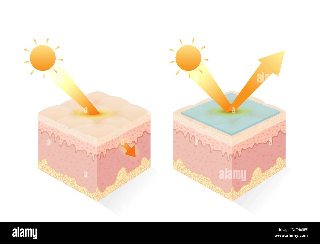 Rayons UV Protection de la peau avec et sans filtre UV. Illustration de Vecteur