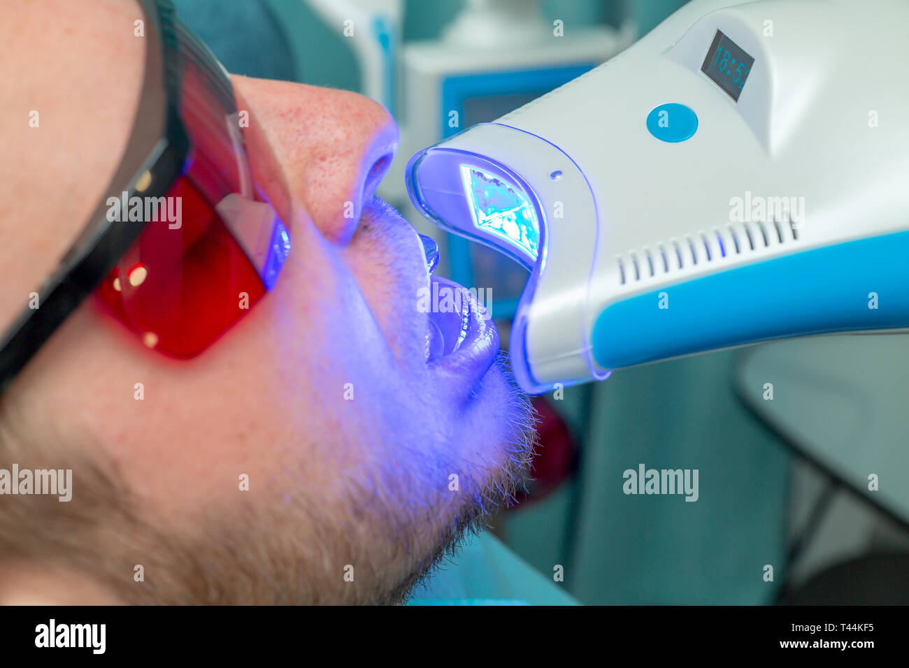 Lampe De Polymérisation Dentaire à LED UV - Modèle LV-8 VVDental - Pour Orthodontie Et Soins