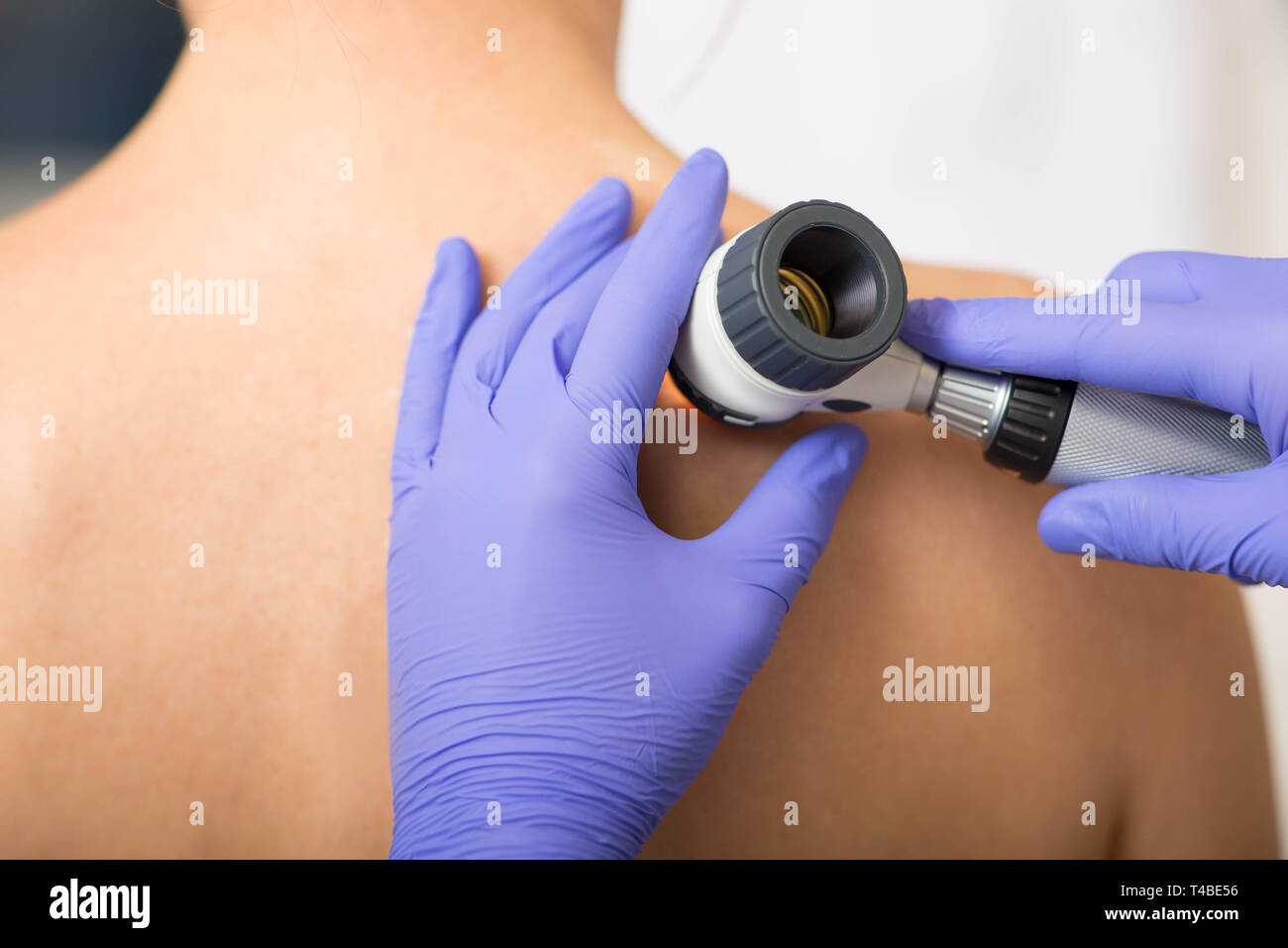 L'inspection des grains de la peau du patient dermatologue à la clinique Banque D'Images