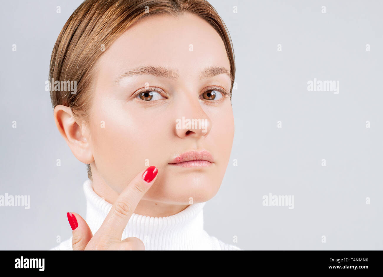 Maladie Des Levres Banque D Image Et Photos Alamy