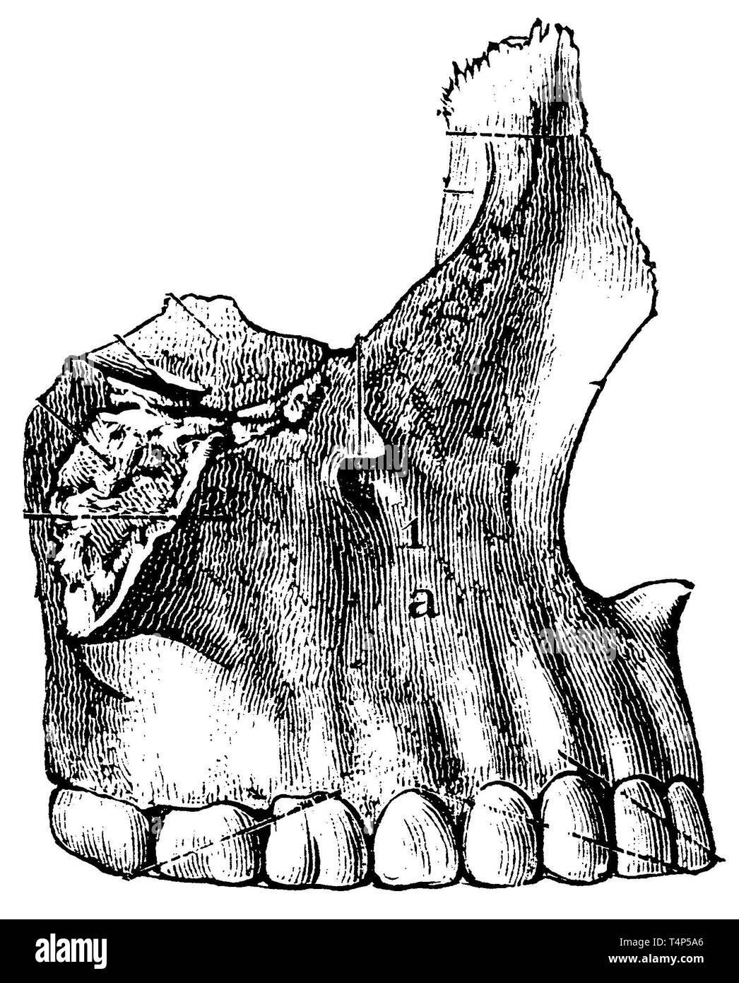 Les droits de l'os maxillaire, droite : vue extérieure, anonym 1887 Banque D'Images