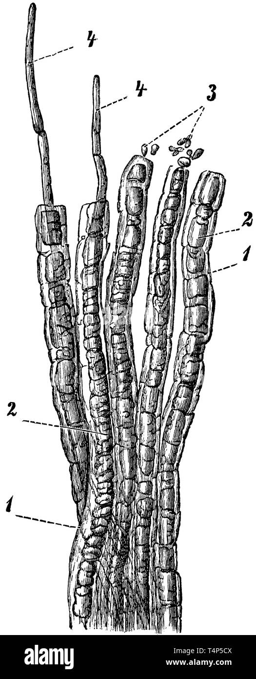 Nerf. 1) la gaine des nerfs, 2) gaine médullaire en ruine dont les particules apparaissent aux 3), 4) vérin axial, anonym 1887 Banque D'Images
