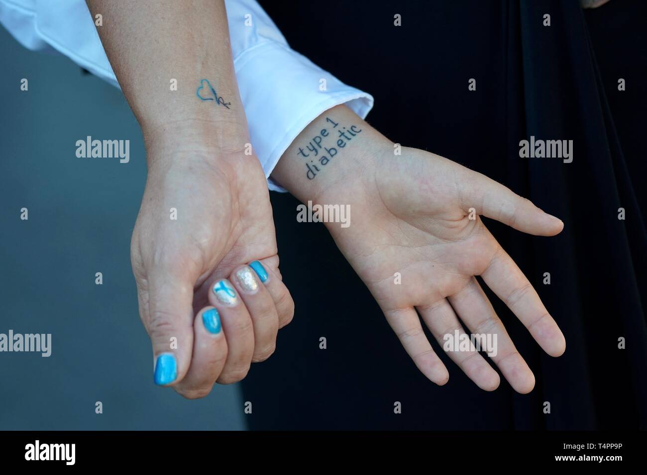Un fils avec le diabète de type 1, montre son tatouage médical a bandes