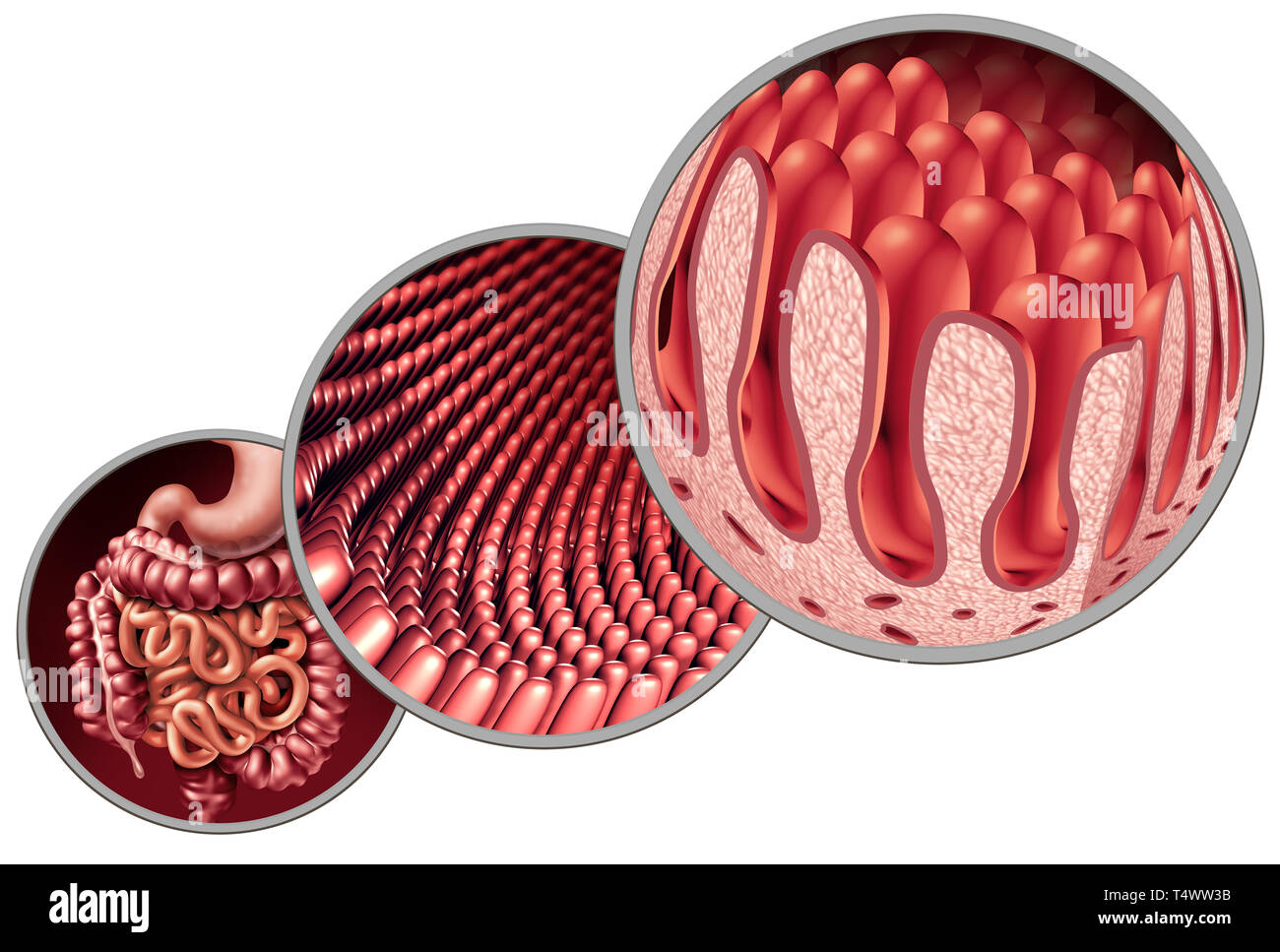 Villosités intestinales comme doublure de l'intestin avec capillaire microscopique comme un concept médical anatomie d'une maladie auto-immune comme la digestion et troubles gastro-intestinaux. Banque D'Images