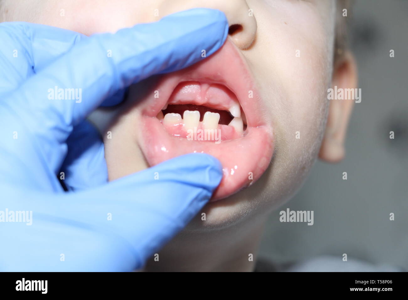 Un Dentiste Examine Les Dents De Bebe Dans Le Garcon La Perte De Dents De Lait Le Garcon N A Pas De Dents Centrale Superieure La Perte De Dents De Lait Chez Les