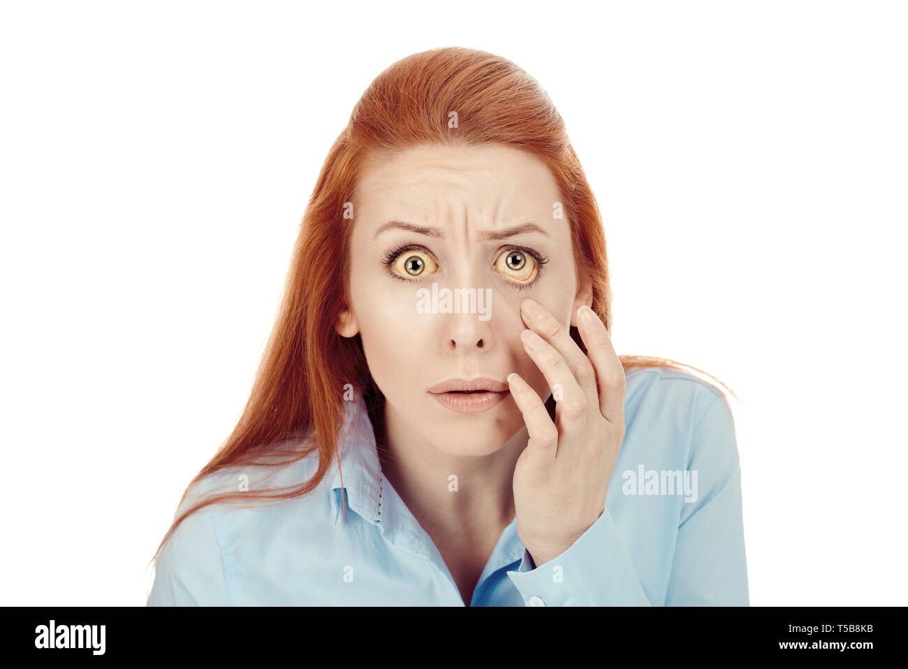 Femme contrôler son état de santé à la recherche dans son œil, closeup portrait isolé sur fond blanc. Yeux jaunâtre est signe de problèmes de foie Banque D'Images