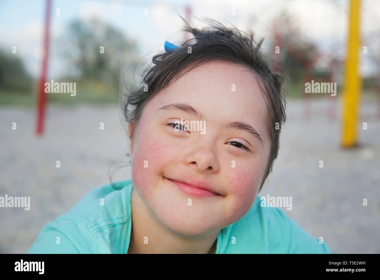 Portrait de syndrome de Down girl smiling Photo Stock - Alamy