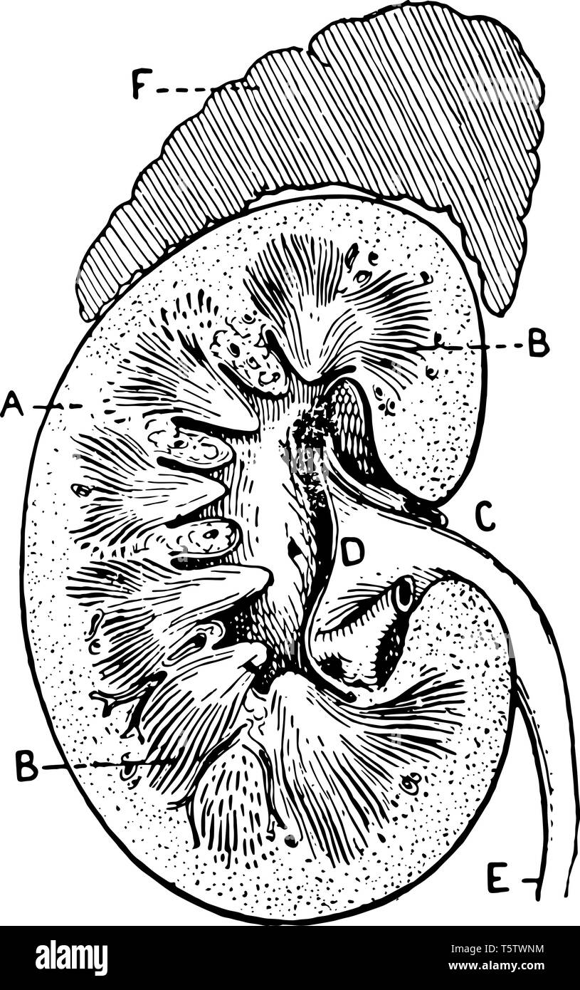 Cette illustration représente la Section de rein humain, vintage dessin ou gravure illustration. Illustration de Vecteur