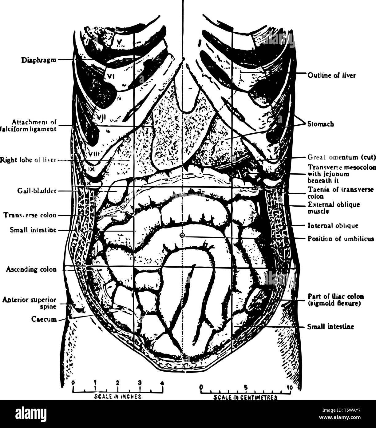 Les viscères abdominaux in situ comme vu lors de l'abdomin est ouverte et le grand omentum retiré vintage dessin ou gravure illustration. Illustration de Vecteur Les viscères abdominaux in situ comme vu lors de l'abdomin est ouverte et le grand omentum retiré vintage dessin ou gravure illustration. Illustration de Vecteur