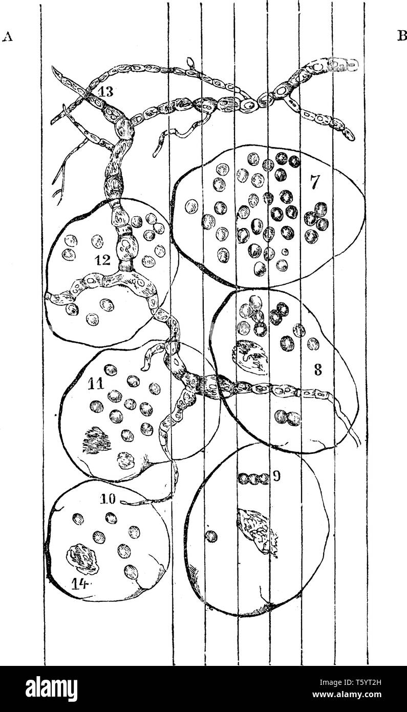 Une vue microscopique d'un moût fermenté apple. Certaines parties de la pâte pourris ont été placés sur une diapositive microscopiques, divisée en centièmes et millièmes d'un Illustration de Vecteur