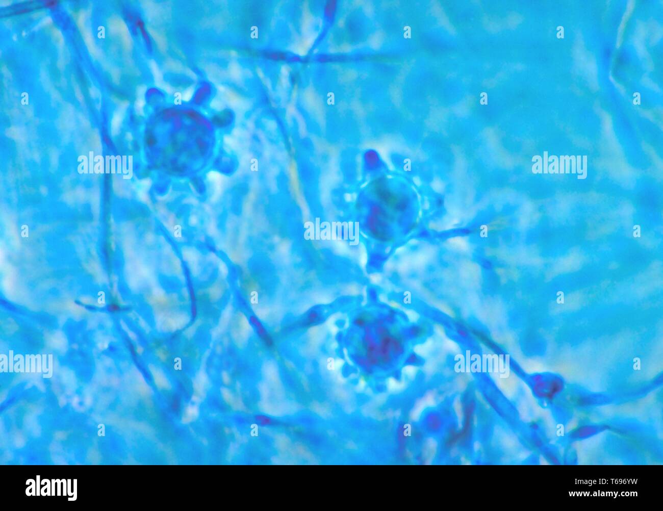 La photomicrographie de macroconidies multiples du champignon Histoplasma capsulatum, 1963. Image courtoisie Centres for Disease Control and Prevention (CDC) / Dr Libero Ajello. () Banque D'Images