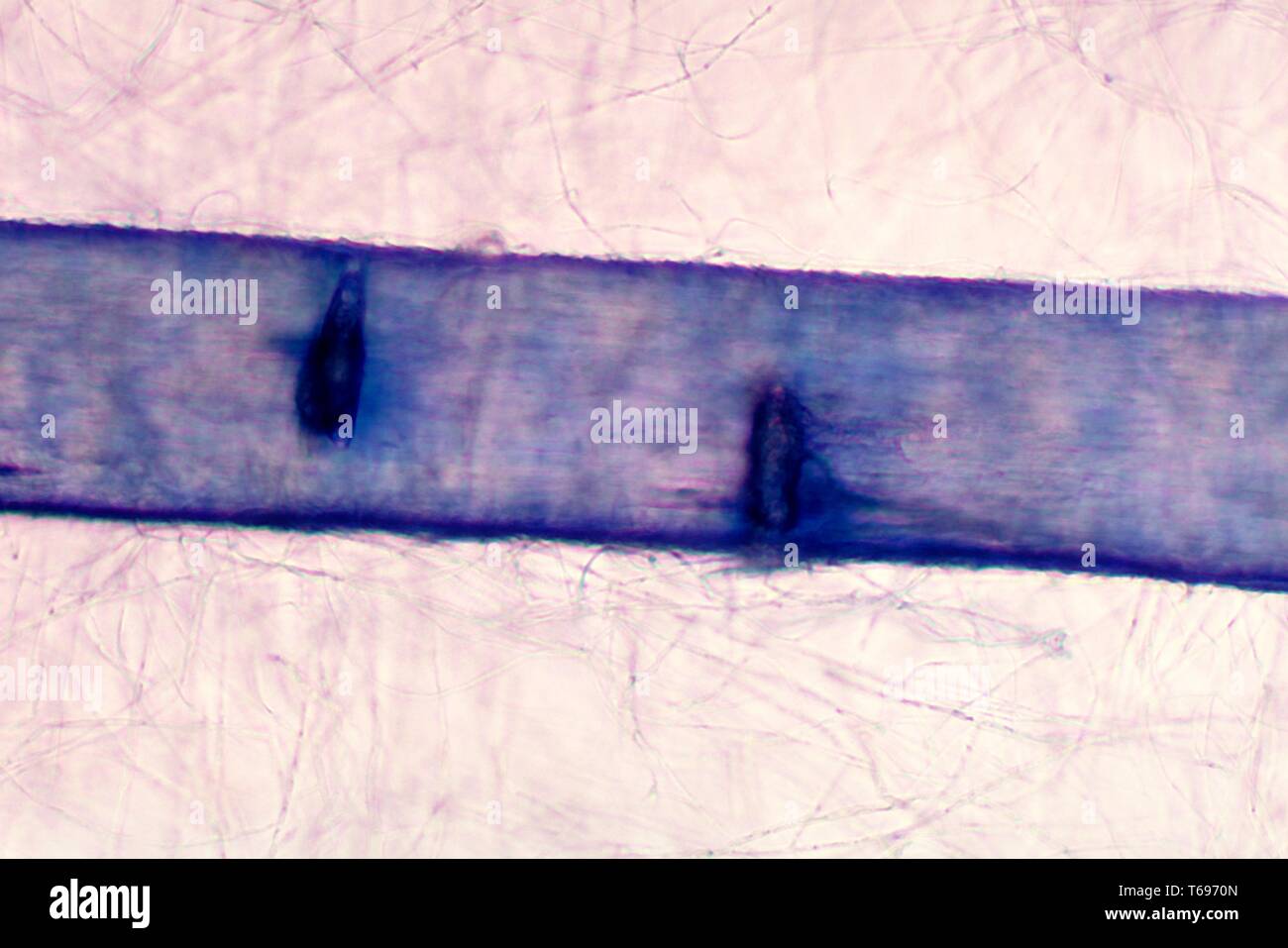 Microphotographie de la perforation des cheveux provoquée par le champignon Arthroderma otae (Microsporum canis), 1978. Image courtoisie Centres for Disease Control and Prevention (CDC) / Dr Arvind A. Padhye. () Banque D'Images