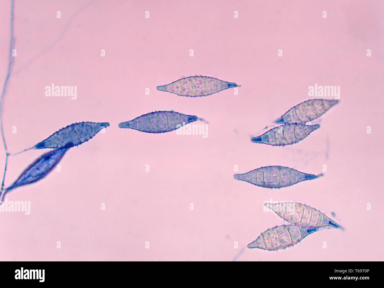 La photomicrographie de champignon multiples otae Arthroderma (Microsporum canis), 1978. Image courtoisie Centres for Disease Control and Prevention (CDC) / Dr Arvind A. Padhye. () Banque D'Images