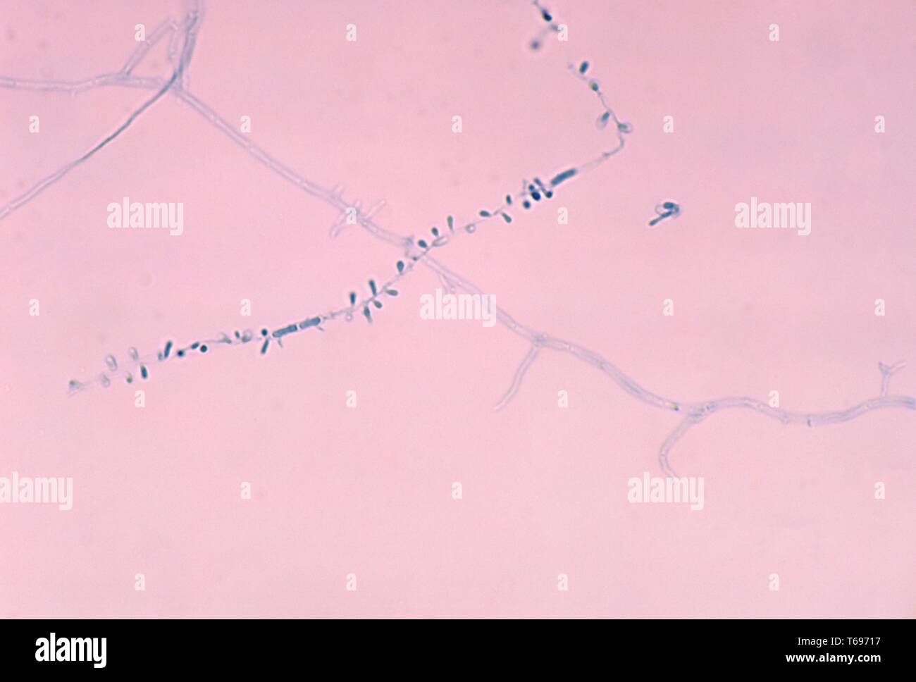Photomicrographie des microconidies du champignon Arthroderma otae (Microsporum canis), 1978. Image courtoisie Centres for Disease Control and Prevention (CDC) / Dr Arvind A. Padhye. () Banque D'Images