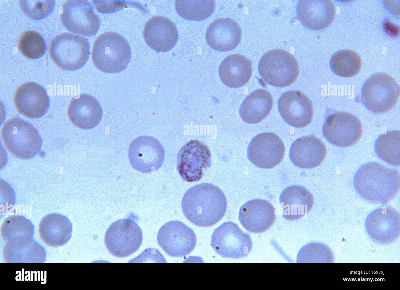 Micrographie de film de la maturité, Plasmodium malariae pigmentées, la chromatine étirée trophozoïte et irréguliers cytoplasme, 1965. () Banque D'Images