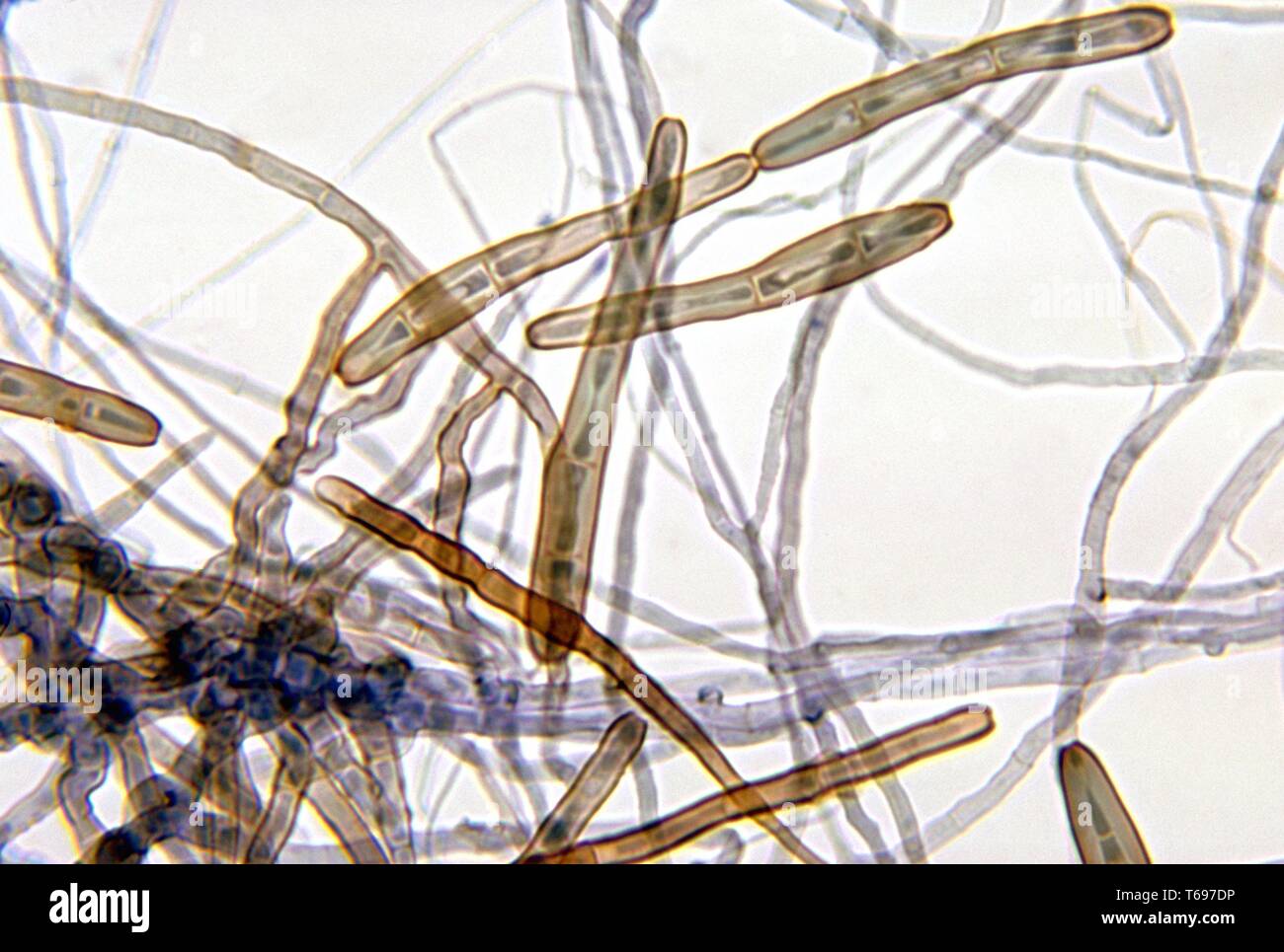 Photomicrographie de le moule Corynespora cassiicolat connus pour provoquer l'apparition de taches sur les feuilles de la maladie, une infection fongique dans les plantes, 1972. Image courtoisie CDC/Dr. Libero Ajello. () Banque D'Images