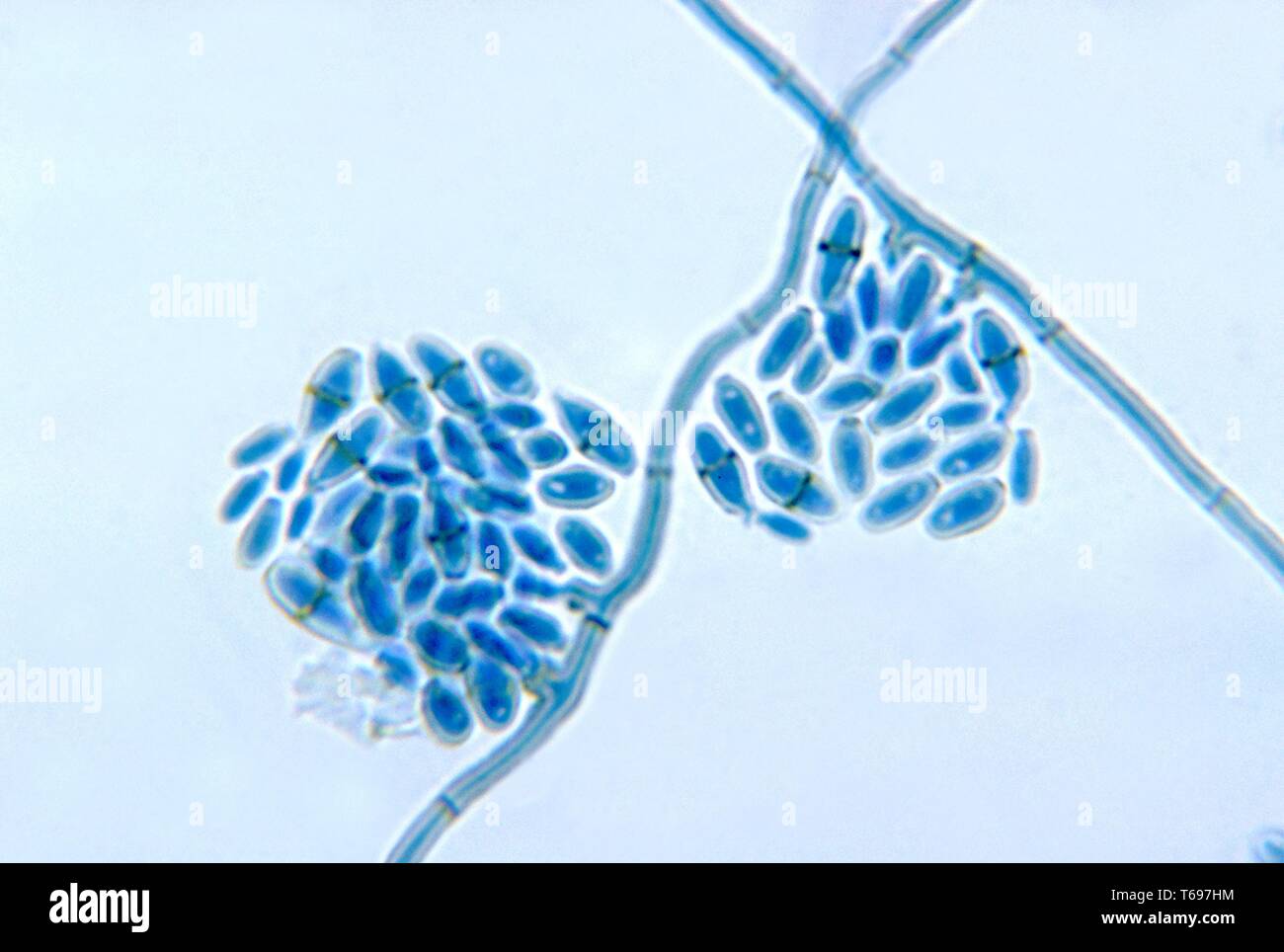 Photomicrographie des conidiophores avec les conidies du champignon Cladosporium werneckii, 1972. Image courtoisie Centres for Disease Control and Prevention (CDC) / Dr Libero Ajello. () Banque D'Images