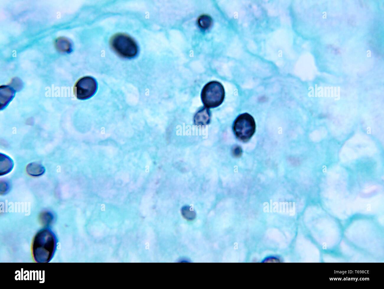 La photomicrographie de changements histopathologiques dans l'histoplasmose causé par le champignon Histoplasma duboisii saprotrophes, 1972. Image courtoisie Centres for Disease Control and Prevention (CDC) / Dr Libero Ajello. () Banque D'Images