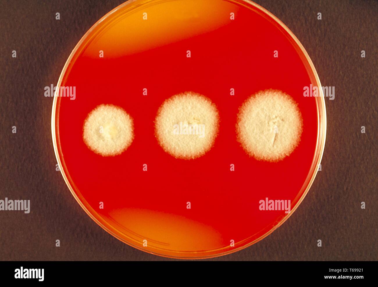 Gros plan du milieu d'essai Dermatophyte (DTM) plaque de gélose à la culture avec des colonies d'espèces Trichophyton un organisme fongique, 1970. Image courtoisie Centres for Disease Control and Prevention (CDC) / Dr Libero Ajello. () Banque D'Images