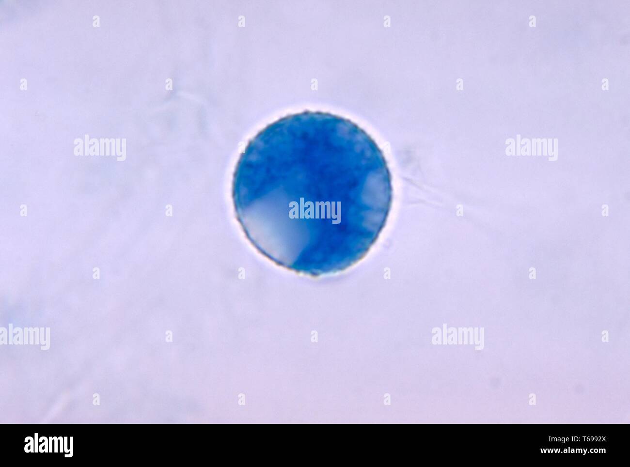 Photomicrographie d'un spore de repos du champignon filamenteux Basidiobolus meristosporus zygomycotic, connu pour causer des infections et des masses sous-cutanées s'ulcérant non chez l'homme, 1970. Image courtoisie Centres for Disease Control and Prevention (CDC) / Dr Libero Ajello. () Banque D'Images