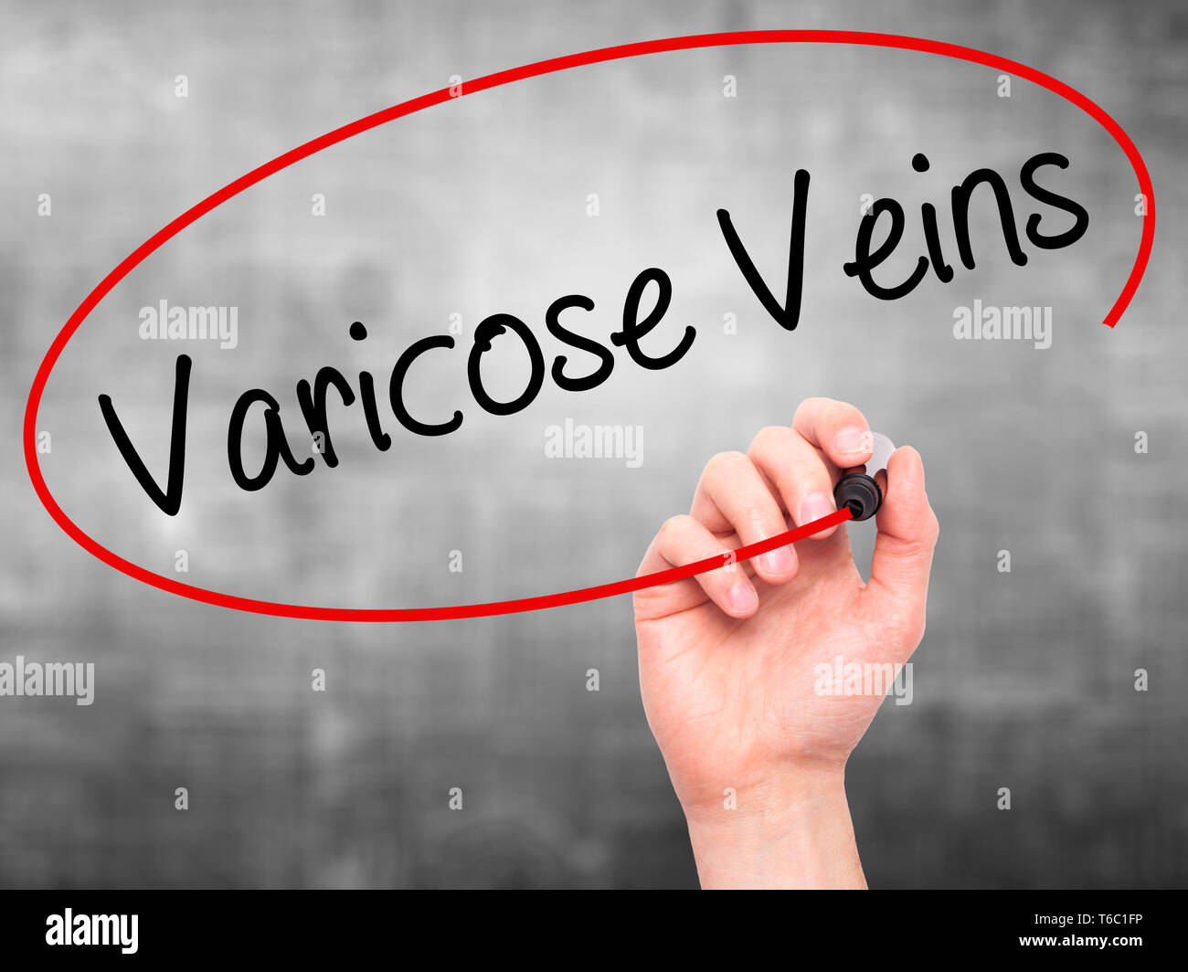 Man main écrit Varices avec marqueur noir sur l'écran visuel Banque D'Images